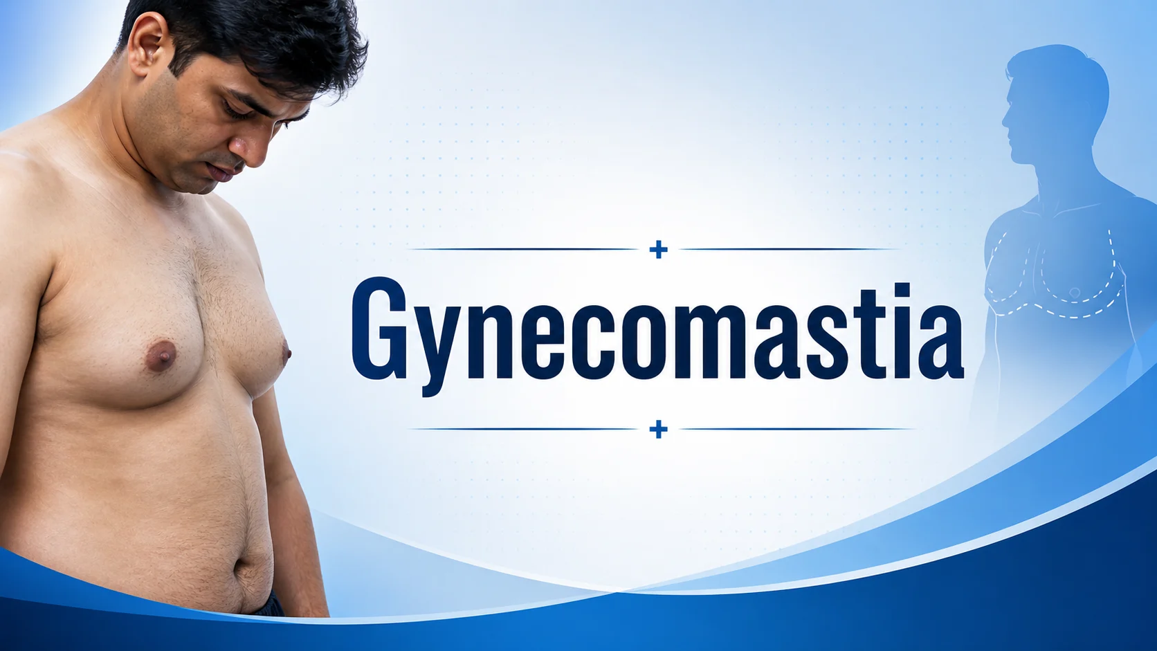 Gynecomastia surgery in Delhi – male breast reduction by Dr. Anshumali Misra